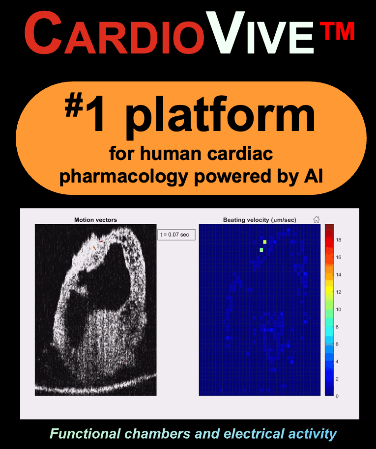 CardioVive beating heart model demo showing motion vectors and velocity mapping