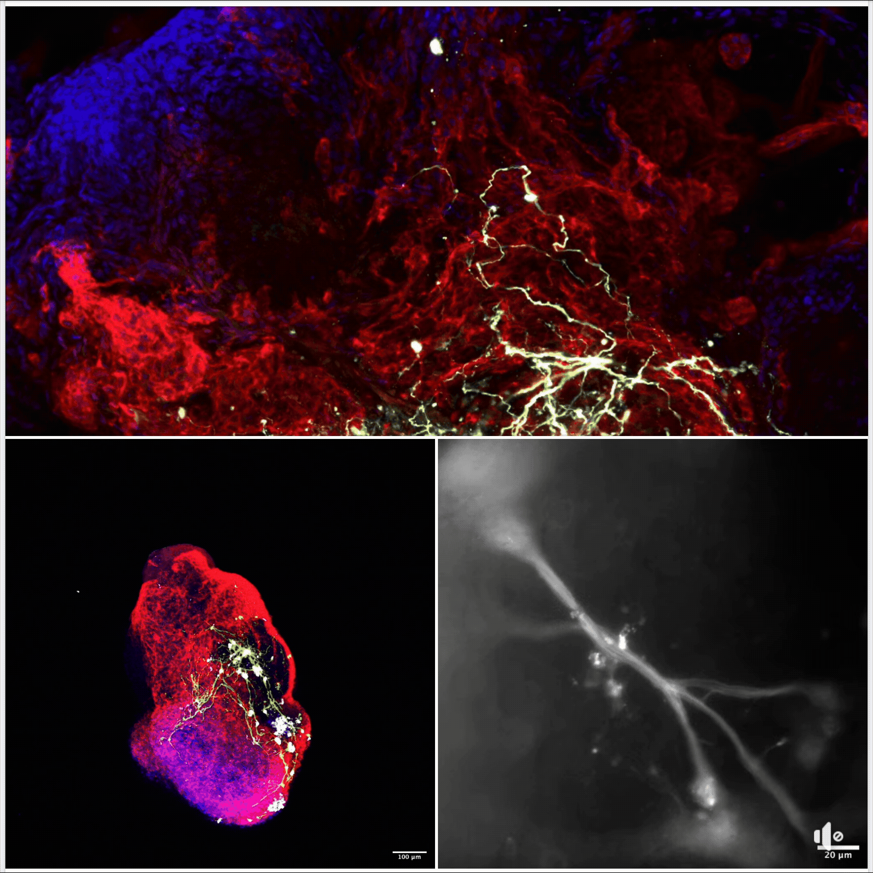 Neural crest heart assembloid visualization